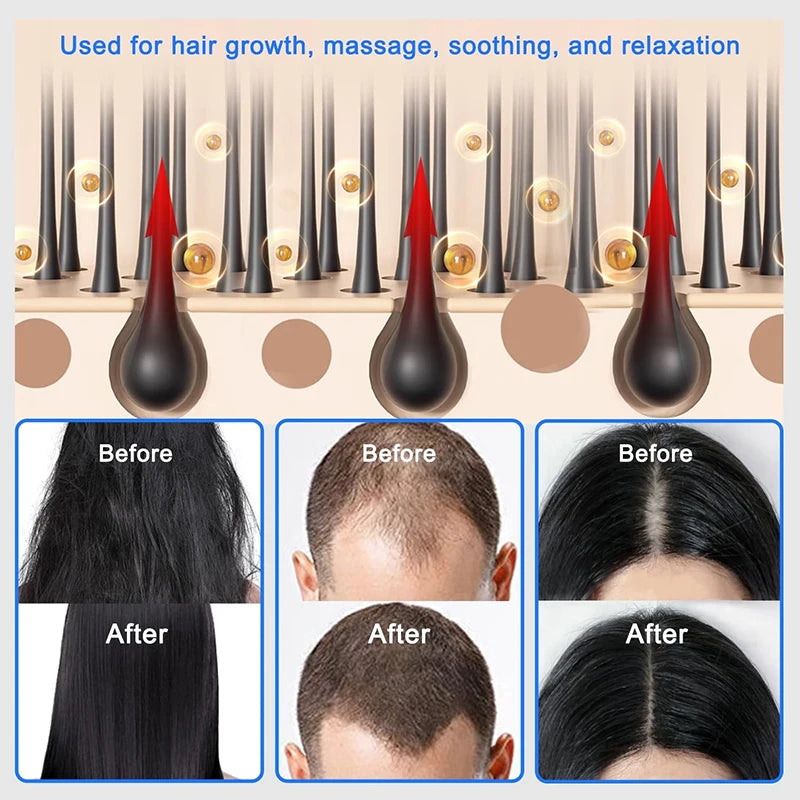 Electric Laser Hair Growth Comb Red Blue Light Magnetic Therapy Head Massage Brush Anti Hair Loss  Hair Treatment Scalp Massager